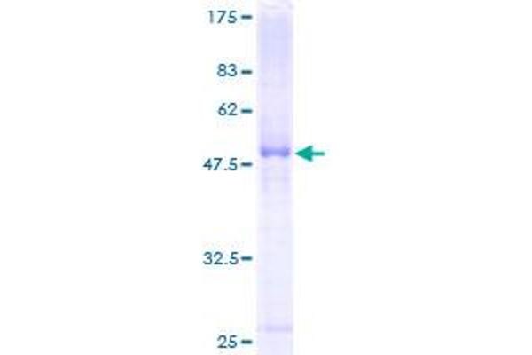 SERPINB5 Protein (AA 1-231) (GST tag)