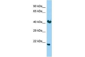 Host: Rabbit Target Name: KDELR2 Sample Type: Fetal Brain lysates Antibody Dilution: 1. (KDELR2 antibody  (C-Term))