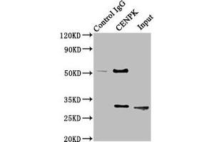 Immunoprecipitating CENPK in Hela whole cell lysate Lane 1: Rabbit control IgG instead of ABIN7147366 in Hela whole cell lysate.