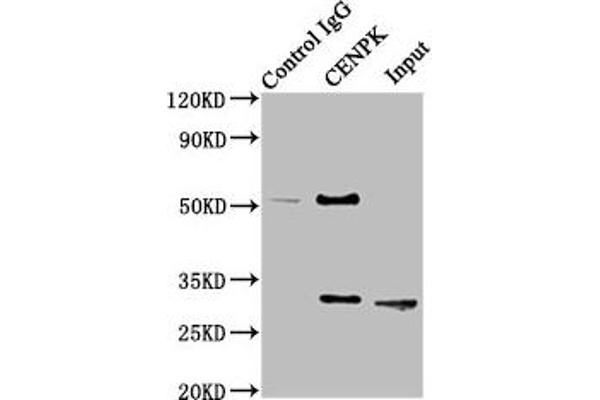 CENPK Antikörper  (AA 1-269)