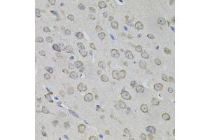 Immunohistochemistry of paraffin-embedded mouse brain using MYO10 antibody. (Myosin X antibody)