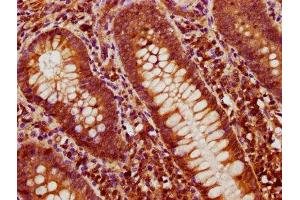 IHC image of ABIN7145692 diluted at 1:600 and staining in paraffin-embedded human appendix tissue performed on a Leica BondTM system. (BMP4 antibody  (AA 303-408))