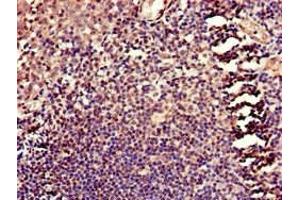 Immunohistochemistry of paraffin-embedded human tonsil tissue using ABIN7158660 at dilution of 1:100 (HELLS antibody  (AA 550-600))