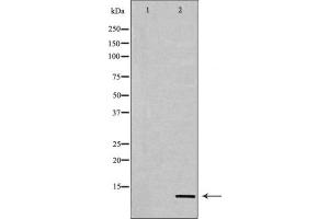 Western blot analysis of extracts from COS7 cells, treated with TSA 400nM 24h, using Acetyl-Histone H4 (Lys12) Antibody. (Histone H4 antibody  (acLys12))