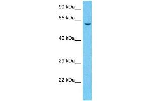 Host:  Rabbit  Target Name:  MNT  Sample Type:  Fetal Lung lysates  Antibody Dilution:  1. (MNT antibody  (C-Term))