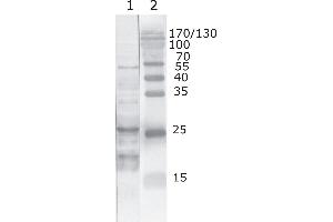Western Blot testing of HIV-1 recombinant Tat protein. (HIV-1 Tat antibody  (AA 6-12))
