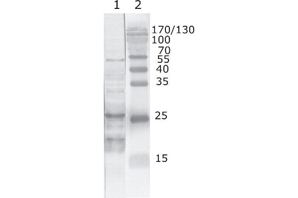 HIV-1 Tat antibody  (AA 6-12)