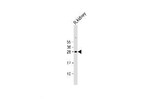 Western Blot at 1:2000 dilution + Rat kidney lysate Lysates/proteins at 20 ug per lane. (EPO antibody  (N-Term))