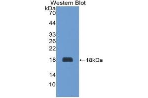Detection of Recombinant AGRP, Rat using Polyclonal Antibody to Agouti Related Protein (AGRP) (AGRP antibody  (AA 34-127))