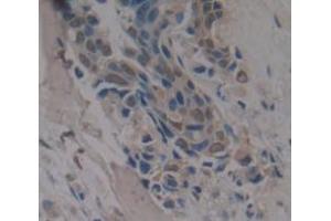 Figure. (RBM20 antibody  (AA 1089-1227))