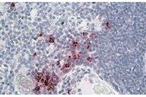 Immunohistochemistry (IHC) image for anti-DEFA1/3 (Internal Region) antibody (ABIN2464584) (DEFA1/3 (Internal Region) antibody)