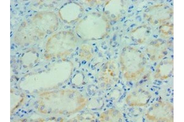 PARP3 antibody  (AA 294-533)