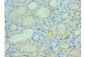 Immunohistochemistry of paraffin-embedded human kidney tissue using ABIN7163755 at dilution of 1:100 (PARP3 antibody  (AA 294-533))
