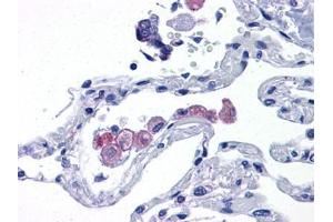 Human Lung: Formalin-Fixed, Paraffin-Embedded (FFPE) (TLR7 antibody  (AA 900-950))