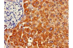 Immunohistochemistry of paraffin-embedded human liver tissue using ABIN7144675 at dilution of 1:100 (NAT1 antibody  (AA 1-288))