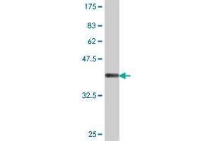 Western Blot detection against Immunogen (37 KDa) . (DDX1 antibody  (AA 642-740))