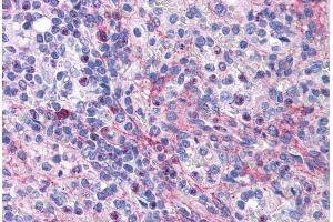 (ABIN571047) (3. (EIF5A antibody  (Internal Region))