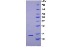 SDS-PAGE (SDS) image for Cystatin A (Stefin A) (CSTA) ELISA Kit (ABIN6574160)