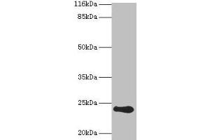 Western blot All lanes: RCVRN antibody at 2 μg/mL + Mouse eye tissue Secondary Goat polyclonal to rabbit IgG at 1/10000 dilution Predicted band size: 24 kDa Observed band size: 24 kDa (Recoverin antibody  (AA 2-200))