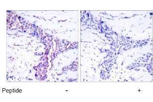 Image no. 1 for anti-Activating Transcription Factor 2 (ATF2) (Thr55), (Thr73) antibody (ABIN197151) (ATF2 antibody  (Thr55, Thr73))