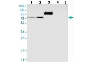 Western blot analysis of Lane 1: RT-4, Lane 2: U-251 MG, Lane 3: Human Plasma, Lane 4: Liver, Lane 5: Tonsil with GARNL4 polyclonal antibody  at 1:250-1:500 dilution. (RAP1GAP2 antibody)