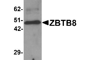 Western Blotting (WB) image for anti-Zinc Finger and BTB Domain Containing 8A (ZBTB8A) (C-Term) antibody (ABIN1030814) (ZBTB8A antibody  (C-Term))