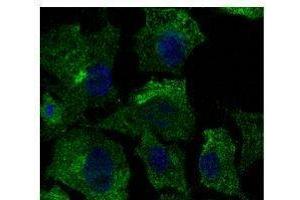 Anti-Calnexin Ab at 1/500 dilution, lysates at 50 per Iane, rabbit polyclonal to goat lµg (HRP) at 1/10,000 dilution, (Caveolin-1 antibody  (N-Term))