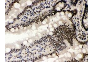 IHC testing of FFPE rat intestine with CSNK1A1 antibody. (CSNK1A1 antibody)