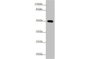 Western blot All lanes: L2HGDH antibody at 4. (L2HGDH antibody  (AA 1-220))