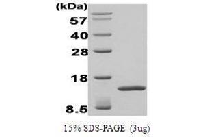 Figure annotation denotes ug of protein loaded and % gel used. (IgG2b Protein (AA 502-636, Fasciclin Domain 4))