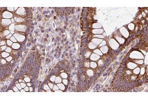 ABIN6272937 at 1/100 staining Mouse colon tissue by IHC-P. (BBS2 antibody  (C-Term))