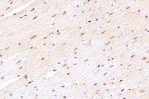 Immunohistochemistry analysis of paraffin-embedded mouse heart using,ZNF154 (ABIN7076261) at dilution of 1: 4000