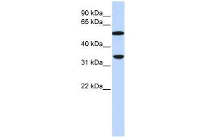WB Suggested Anti-C4B Antibody Titration:  0. (C4B antibody  (N-Term))