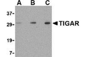 Western blot analysis of TIGAR in EL4 cell lysate with this product at (A) 0. (TIGAR antibody  (Center))