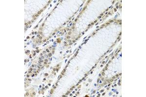 Immunohistochemistry of paraffin-embedded human stomach using TIA1 antibody (ABIN6293426) at dilution of 1:100 (40x lens). (TIA1 antibody)