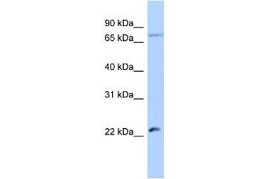 Host:  Rabbit  Target Name:  HSFY2  Sample Type:  Jurkat Whole Cell lysates  Antibody Dilution:  1. (HSFY2 antibody  (Middle Region))