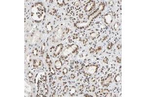 Immunohistochemical staining (Formalin-fixed paraffin-embedded sections) of human kidney with NCOA6 polyclonal antibody  shows nuclear positivity in cells of tubules and glomeruli. (NCOA6 antibody)
