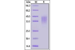 SDS-PAGE (SDS) image for CD28 (CD28) (AA 19-152) (Active) protein (His tag,AVI tag,Biotin) (ABIN6972981)