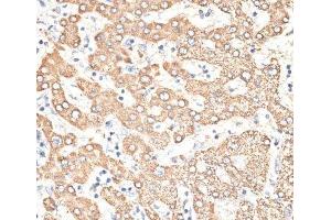 Immunohistochemistry of paraffin-embedded Human liver using KIR3DS1 Polyclonal Antibody at dilution of 1:100 (40x lens). (KIR3DS1 antibody)