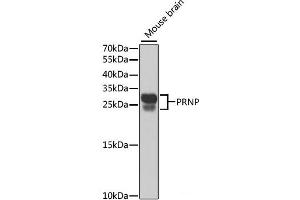 Western blot analysis of extracts of Mouse brain using PRNP Polyclonal Antibody at dilution of 1:1000. (PRNP antibody)