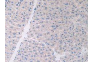 Figure. (ATF6 antibody  (AA 1-377))