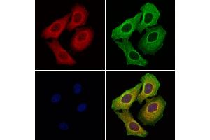 ABIN6257549 and ABIN6276234 staining Hela cells by IF/ICC. (VIPR1 antibody  (Internal Region))