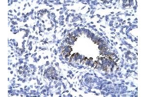 Rabbit Anti-KIF5A antibody   Paraffin Embedded Tissue: Human Lung cell Cellular Data: bronchiole epithelium of renal tubule Antibody Concentration: 4. (KIF5A antibody  (Middle Region))