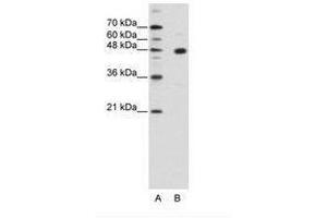 Image no. 1 for anti-PR Domain Containing 12 (PRDM12) (AA 288-337) antibody (ABIN202352) (PRDM12 antibody  (AA 288-337))