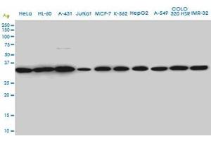 SUPT3H monoclonal antibody (M01A), clone 1A6 Western Blot analysis of SUPT3H expression in HeLa . (SUPT3H/SPT3 antibody  (AA 1-328))