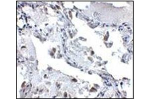Immunohistochemistry of SH3BP4 in human lung tissue with this product at 5 μg/ml. (SH3BP4 antibody  (C-Term))