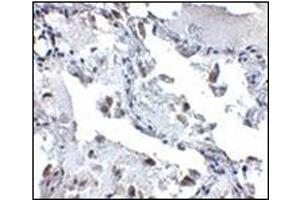 Immunohistochemistry of SH3BP4 in human lung tissue with this product at 5 μg/ml.