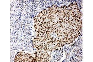 Immunohistochemistry (IHC) image for anti-T-Complex 1 (TCP1) (AA 82-98) antibody (ABIN3029087)