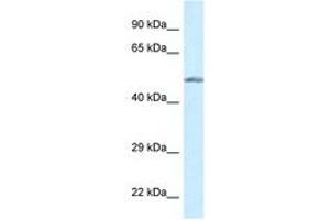 Image no. 1 for anti-Glucokinase (Hexokinase 4) (GCK) (AA 84-133) antibody (ABIN6747601) (GCK antibody  (AA 84-133))