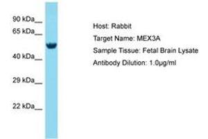 Image no. 1 for anti-Mex-3 Homolog A (MEX3A) (AA 172-221) antibody (ABIN6750731) (MEX3A antibody  (AA 172-221))